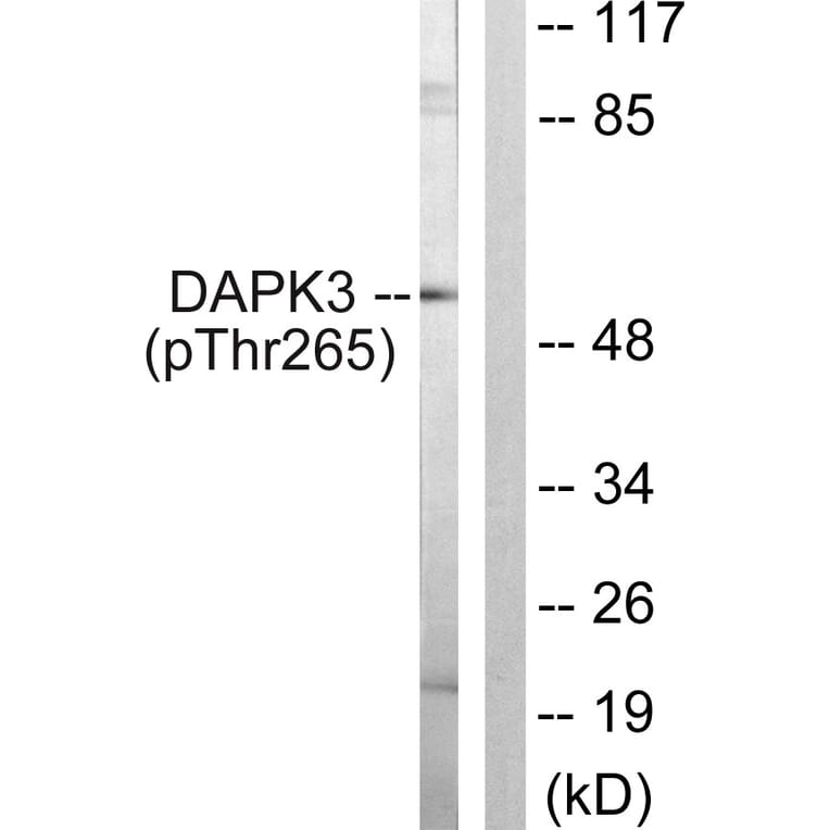 Western Blot - Anti-DAPK3 (phospho Thr265) Antibody (A0900) - Antibodies.com