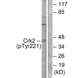 Western Blot - Anti-CrkII (phospho Tyr221) Antibody (A0066) - Antibodies.com
