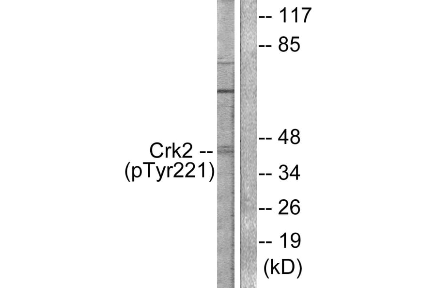 Western Blot - Anti-CrkII (phospho Tyr221) Antibody (A0066) - Antibodies.com