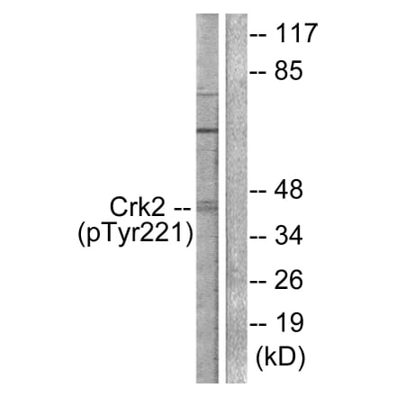 Western Blot - Anti-CrkII (phospho Tyr221) Antibody (A0066) - Antibodies.com