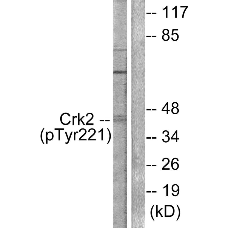 Western Blot - Anti-CrkII (phospho Tyr221) Antibody (A0066) - Antibodies.com