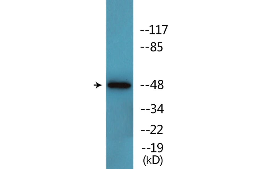 Western Blot - Anti-SAPK (phospho Tyr185) Antibody (P12-1175) - Antibodies.com