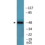 Western Blot - Anti-SAPK (phospho Tyr185) Antibody (P12-1175) - Antibodies.com