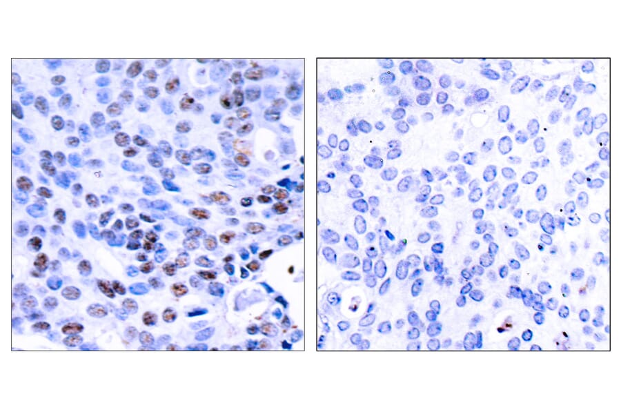 Immunohistochemistry - Anti-NF kappa B p105 / p50 Antibody (B7166) - Antibodies.com