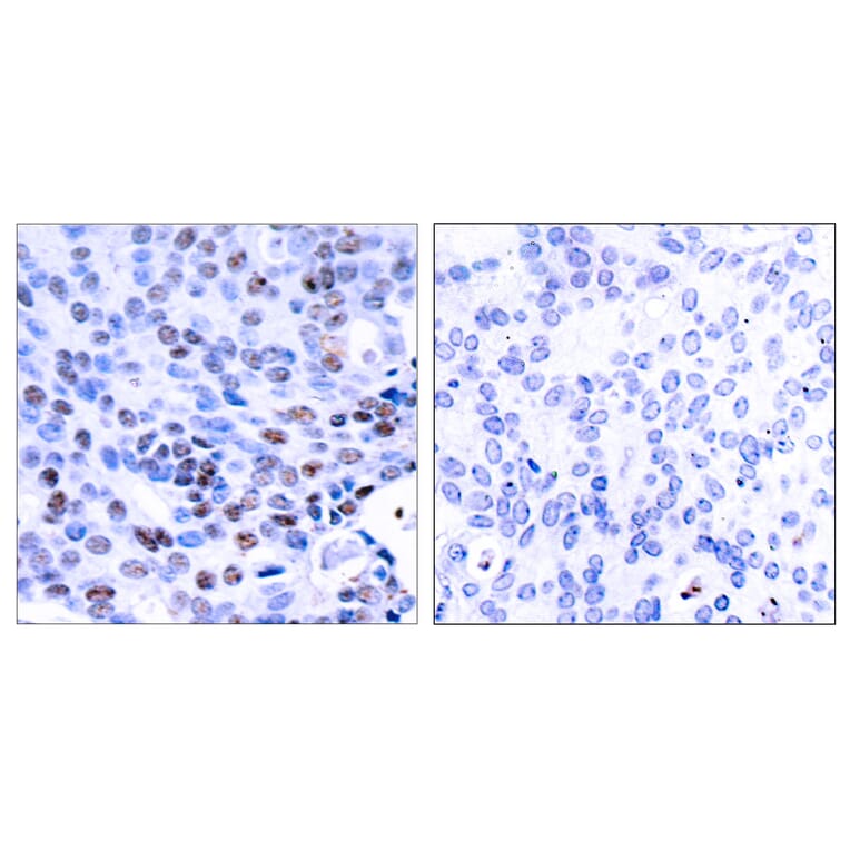 Immunohistochemistry - Anti-NF kappa B p105 / p50 Antibody (B7166) - Antibodies.com