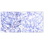 Immunohistochemistry - Anti-NF kappa B p105 / p50 Antibody (B7166) - Antibodies.com