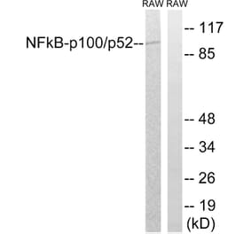 Western Blot - Anti-NF kappa B p100 / p52 Antibody (B7165) - Antibodies.com