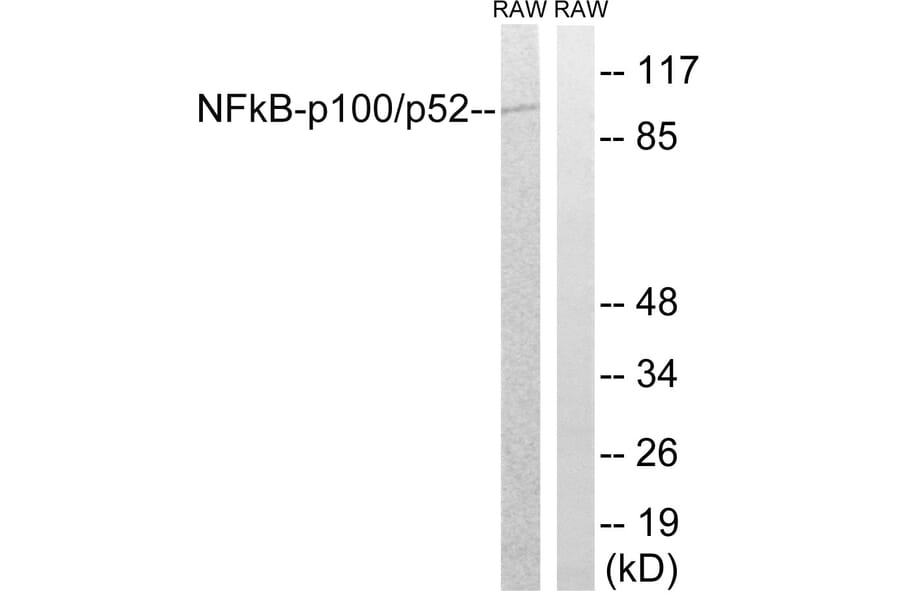 Western Blot - Anti-NF kappa B p100 / p52 Antibody (B7165) - Antibodies.com