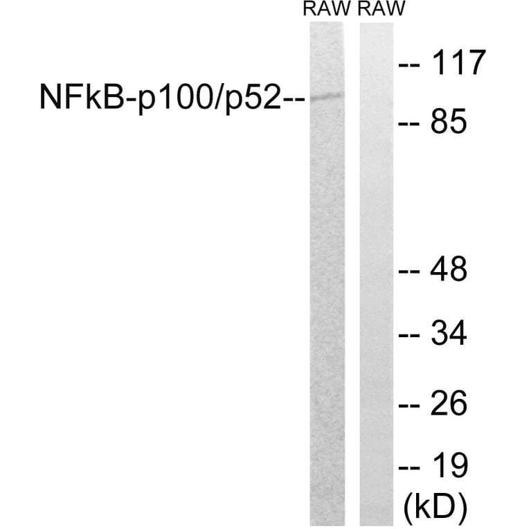 Western Blot - Anti-NF kappa B p100 / p52 Antibody (B7165) - Antibodies.com