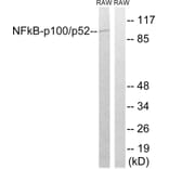 Western Blot - Anti-NF kappa B p100 / p52 Antibody (B7165) - Antibodies.com