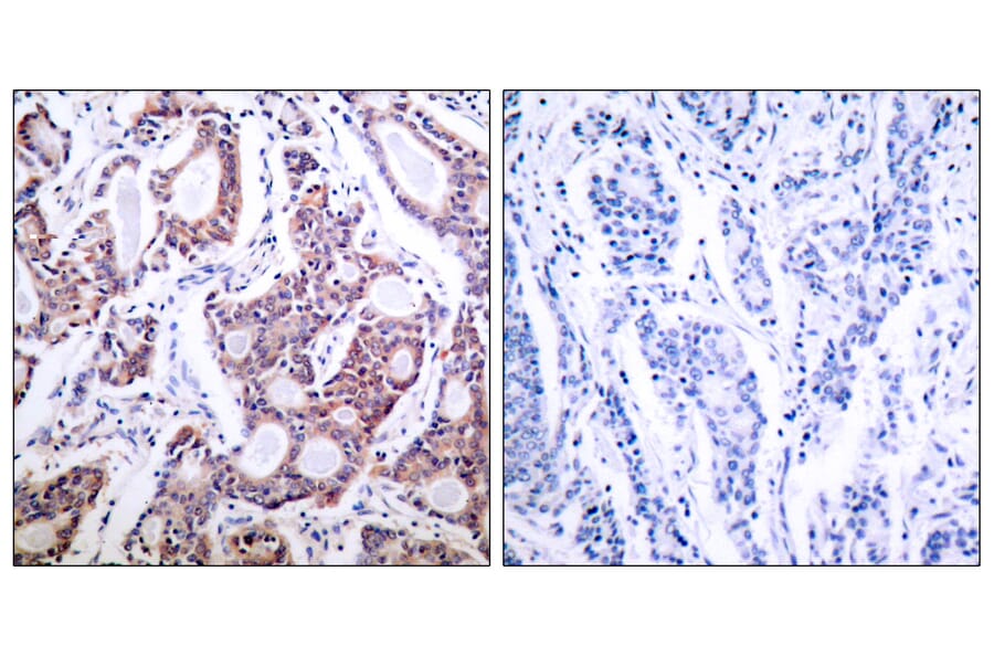 Immunohistochemistry - Anti-NF kappa B p100 / p52 Antibody (B7165) - Antibodies.com