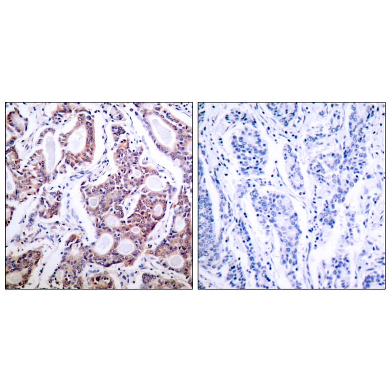 Immunohistochemistry - Anti-NF kappa B p100 / p52 Antibody (B7165) - Antibodies.com