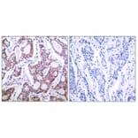 Immunohistochemistry - Anti-NF kappa B p100 / p52 Antibody (B7165) - Antibodies.com
