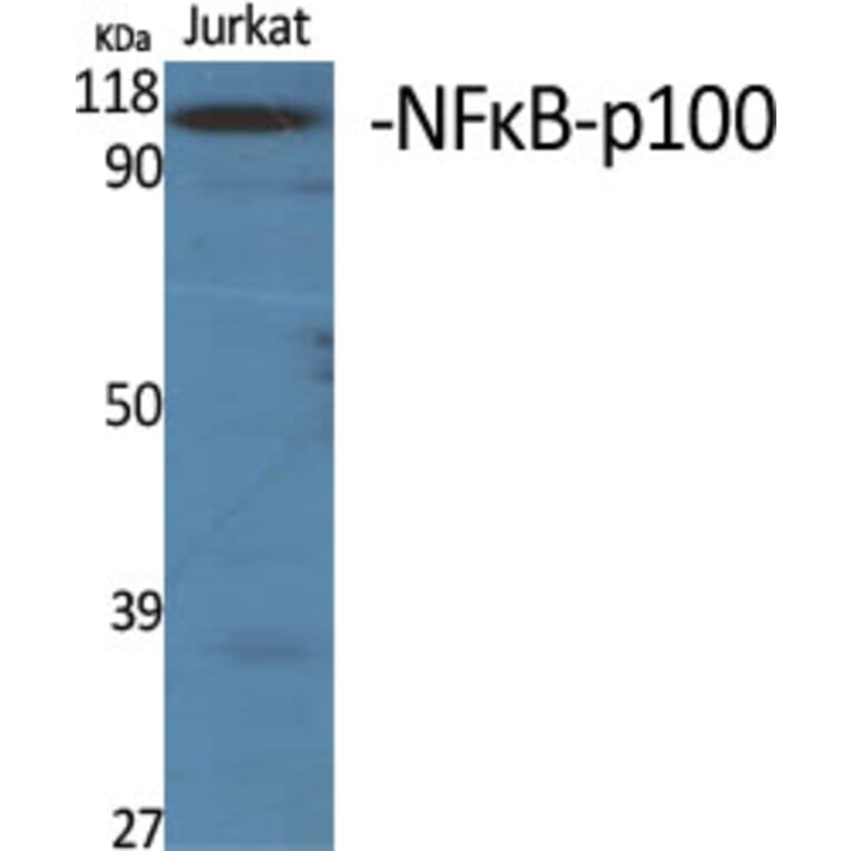 Western Blot - Anti-NF kappa B p100 / p52 Antibody (B7165) - Antibodies.com