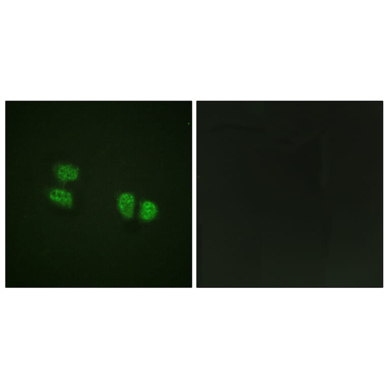 Immunofluorescence - Anti-DDX5 (phospho Tyr593) Antibody (A0903) - Antibodies.com