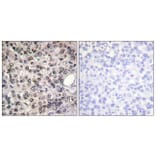 Immunohistochemistry - Anti-DDX5 (phospho Tyr593) Antibody (A0903) - Antibodies.com