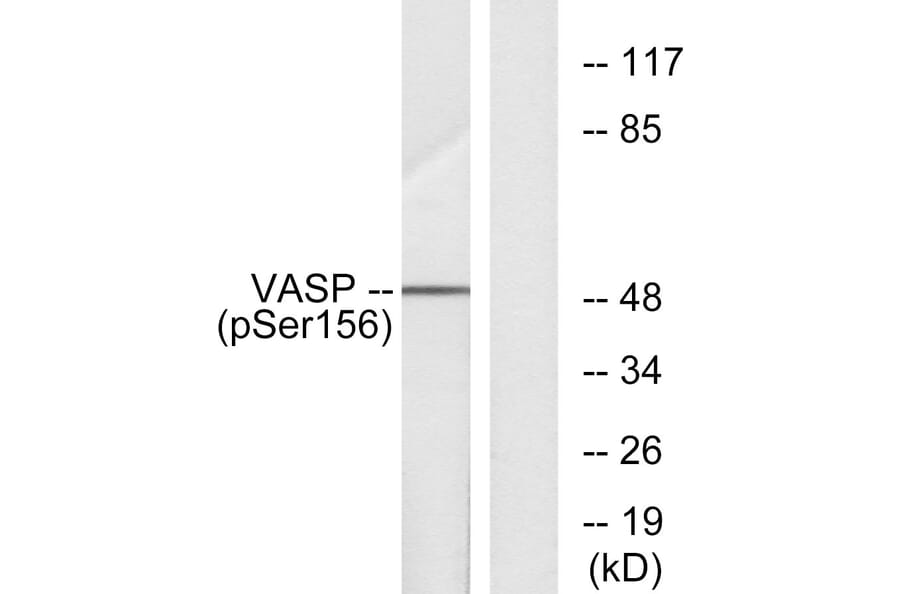 Western Blot - Anti-VASP (phospho Ser157) Antibody (A7249) - Antibodies.com