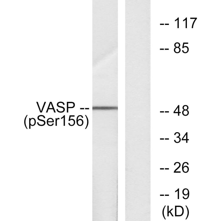 Western Blot - Anti-VASP (phospho Ser157) Antibody (A7249) - Antibodies.com