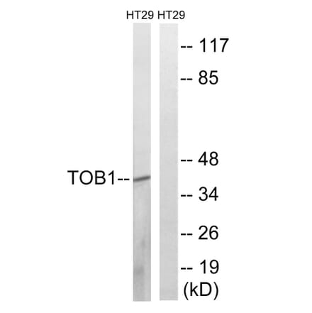 Western Blot - Anti-TOB1 (phospho Ser164) Antibody (A8438) - Antibodies.com