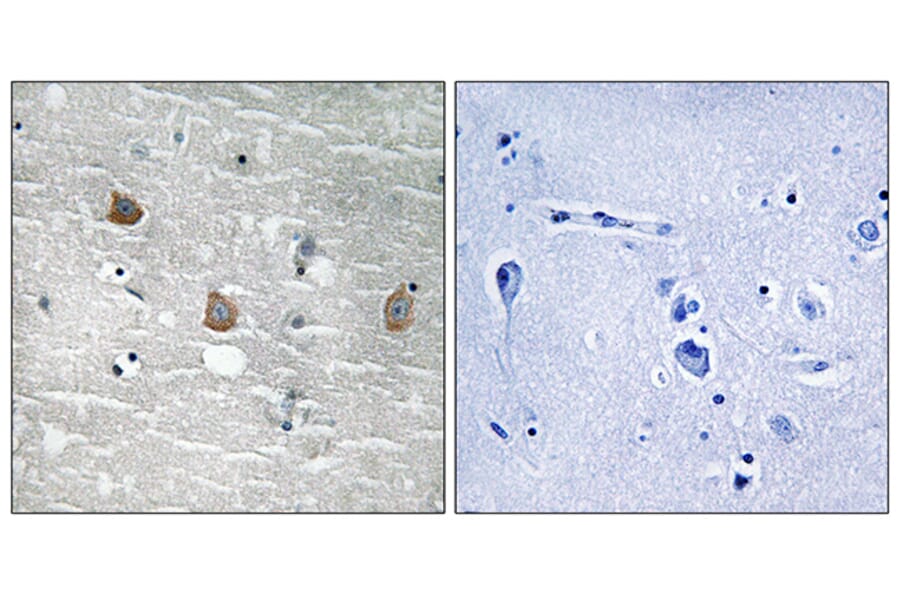 Immunohistochemistry - Anti-TOB1 (phospho Ser164) Antibody (A8438) - Antibodies.com