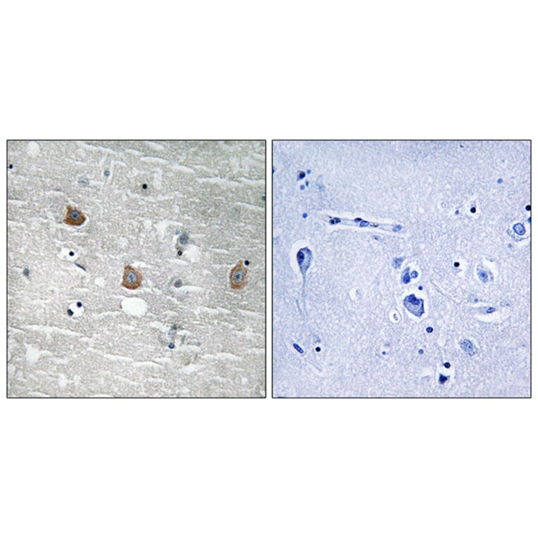 Immunohistochemistry - Anti-TOB1 (phospho Ser164) Antibody (A8438) - Antibodies.com