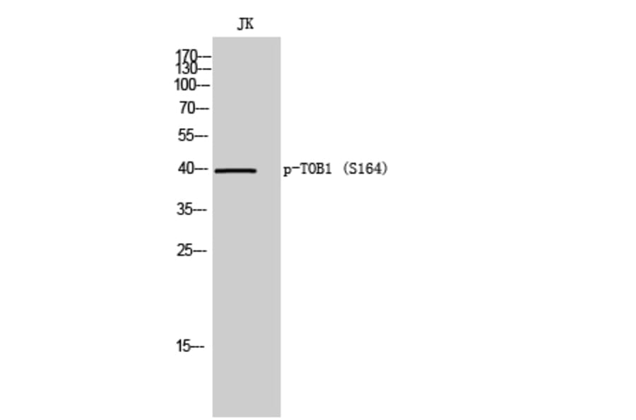 Western Blot - Anti-TOB1 (phospho Ser164) Antibody (A8438) - Antibodies.com