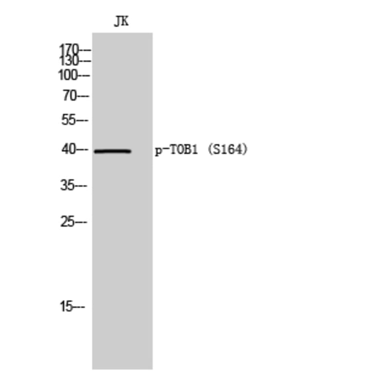 Western Blot - Anti-TOB1 (phospho Ser164) Antibody (A8438) - Antibodies.com