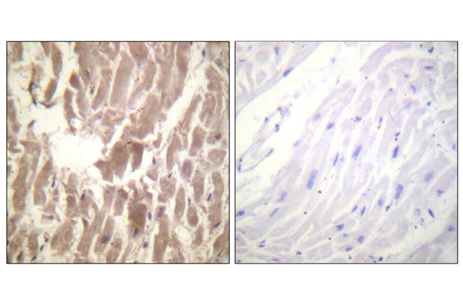Immunohistochemistry - Anti-TNNI3 (phospho Ser43) Antibody (A0816) - Antibodies.com