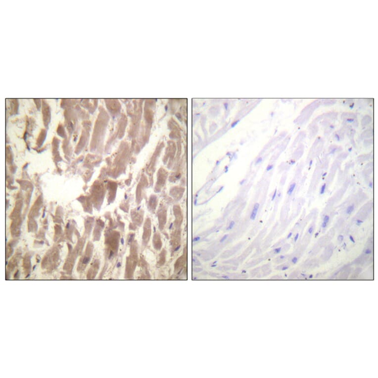 Immunohistochemistry - Anti-TNNI3 (phospho Ser43) Antibody (A0816) - Antibodies.com