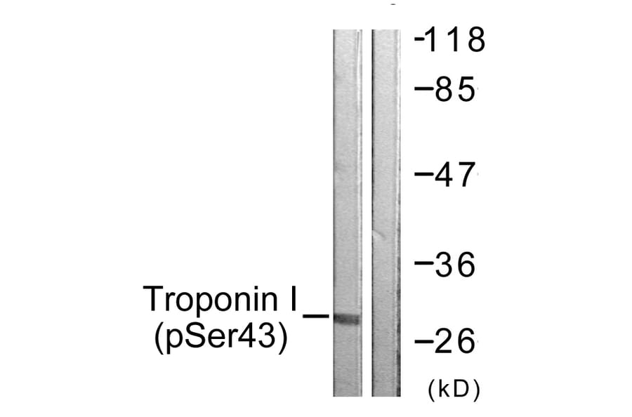 Western Blot - Anti-TNNI3 (phospho Ser43) Antibody (A0816) - Antibodies.com
