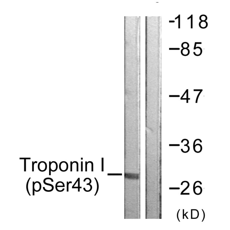 Western Blot - Anti-TNNI3 (phospho Ser43) Antibody (A0816) - Antibodies.com