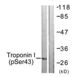 Western Blot - Anti-TNNI3 (phospho Ser43) Antibody (A0816) - Antibodies.com