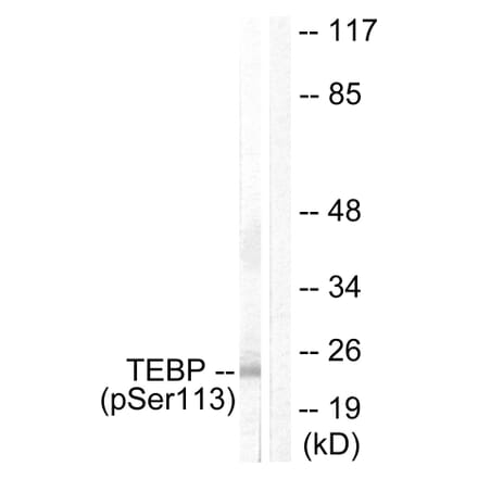 Western Blot - Anti-TEBP (phospho Ser113) Antibody (A0583) - Antibodies.com