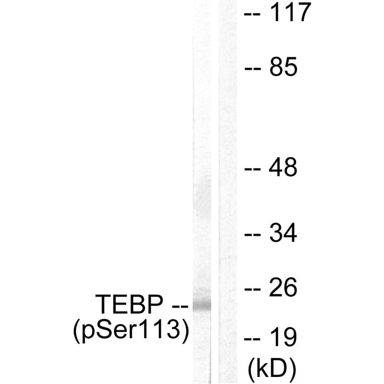 Western Blot - Anti-TEBP (phospho Ser113) Antibody (A0583) - Antibodies.com