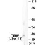 Western Blot - Anti-TEBP (phospho Ser113) Antibody (A0583) - Antibodies.com