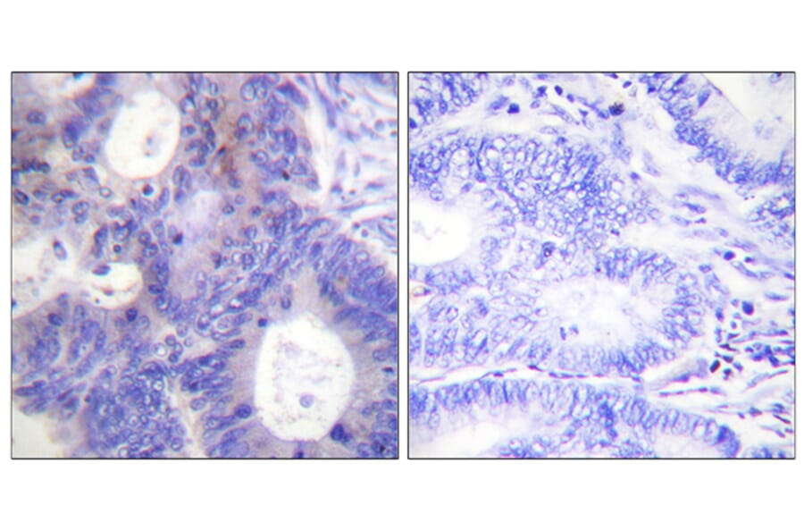 Immunohistochemistry - Anti-TEBP (phospho Ser113) Antibody (A0583) - Antibodies.com