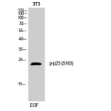 Western Blot - Anti-TEBP (phospho Ser113) Antibody (A0583) - Antibodies.com