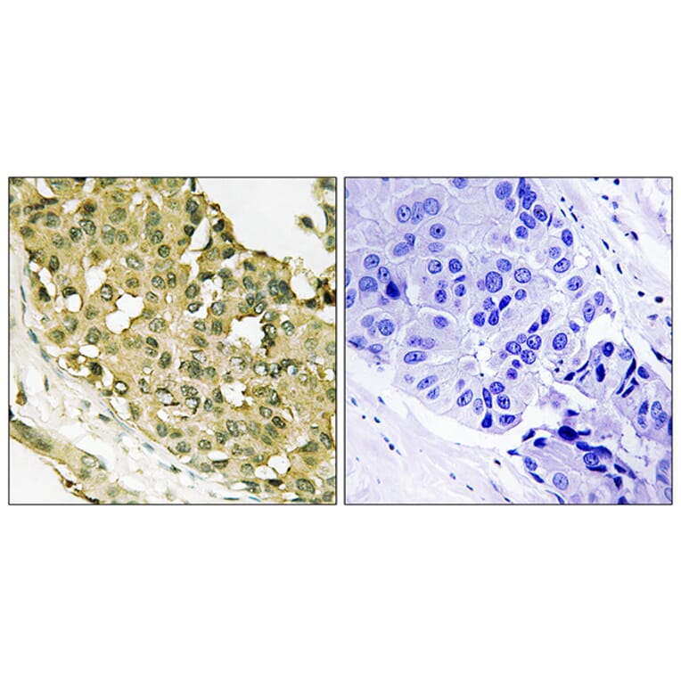 Immunohistochemistry - Anti-STMN1 (phospho Ser62) Antibody (A8066) - Antibodies.com