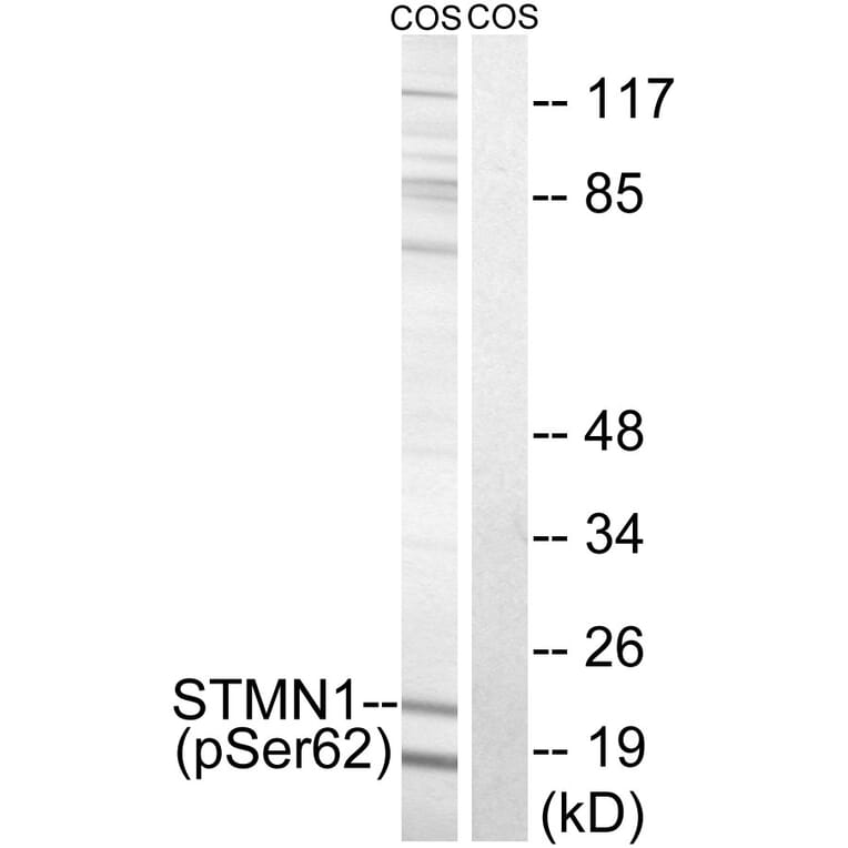 Western Blot - Anti-STMN1 (phospho Ser62) Antibody (A8066) - Antibodies.com