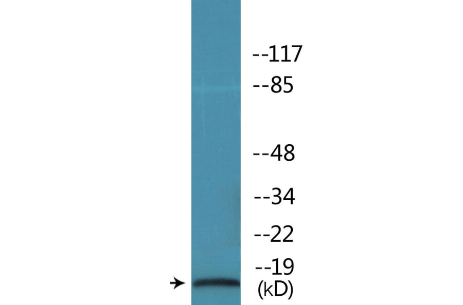 Western Blot - Anti-STMN1 (phospho Ser62) Antibody (P12-1182) - Antibodies.com
