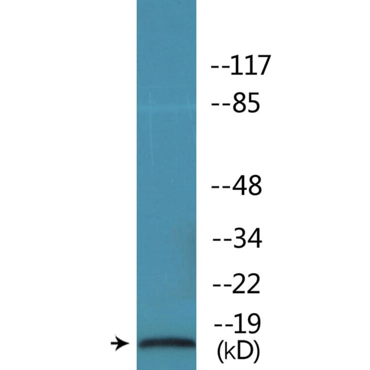 Western Blot - Anti-STMN1 (phospho Ser62) Antibody (P12-1182) - Antibodies.com