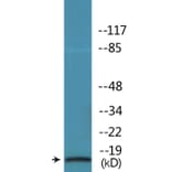 Western Blot - Anti-STMN1 (phospho Ser62) Antibody (P12-1182) - Antibodies.com