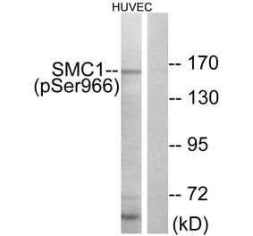 Western Blot - Anti-SMC1 (phospho Ser966) Antibody (A0575) - Antibodies.com