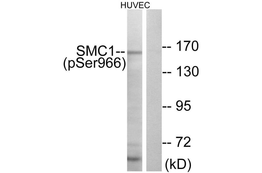 Western Blot - Anti-SMC1 (phospho Ser966) Antibody (A0575) - Antibodies.com