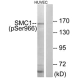 Western Blot - Anti-SMC1 (phospho Ser966) Antibody (A0575) - Antibodies.com