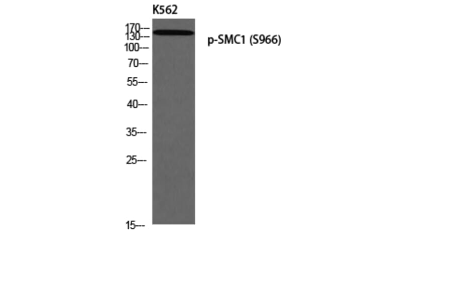 Western Blot - Anti-SMC1 (phospho Ser966) Antibody (A0575) - Antibodies.com