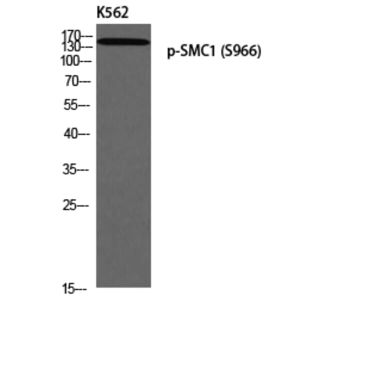 Western Blot - Anti-SMC1 (phospho Ser966) Antibody (A0575) - Antibodies.com
