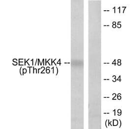 Western Blot - Anti-SEK1 (phospho Thr261) Antibody (A7216) - Antibodies.com