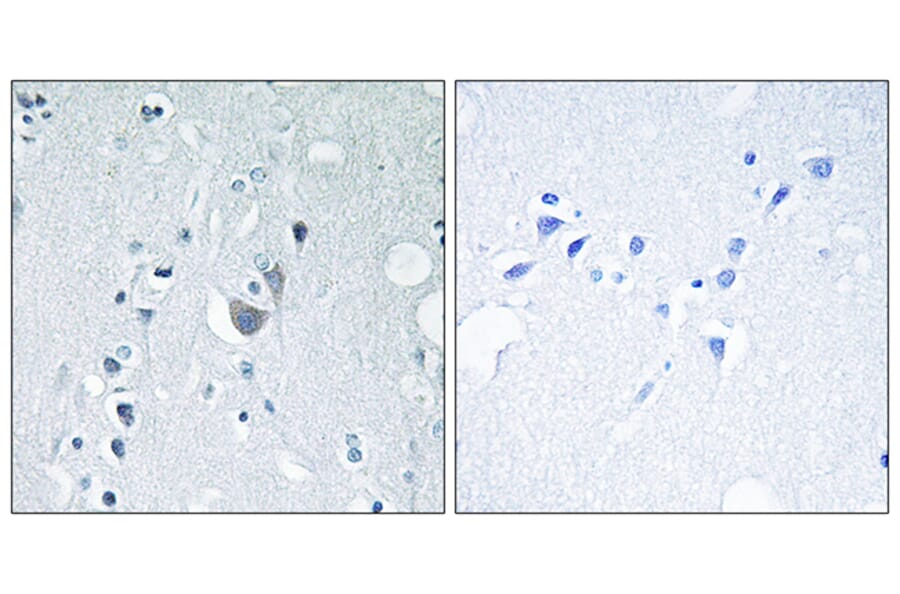 Immunohistochemistry - Anti-SAPK (phospho Tyr185) Antibody (A7129) - Antibodies.com
