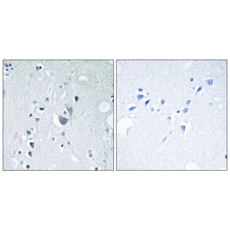 Immunohistochemistry - Anti-SAPK (phospho Tyr185) Antibody (A7129) - Antibodies.com